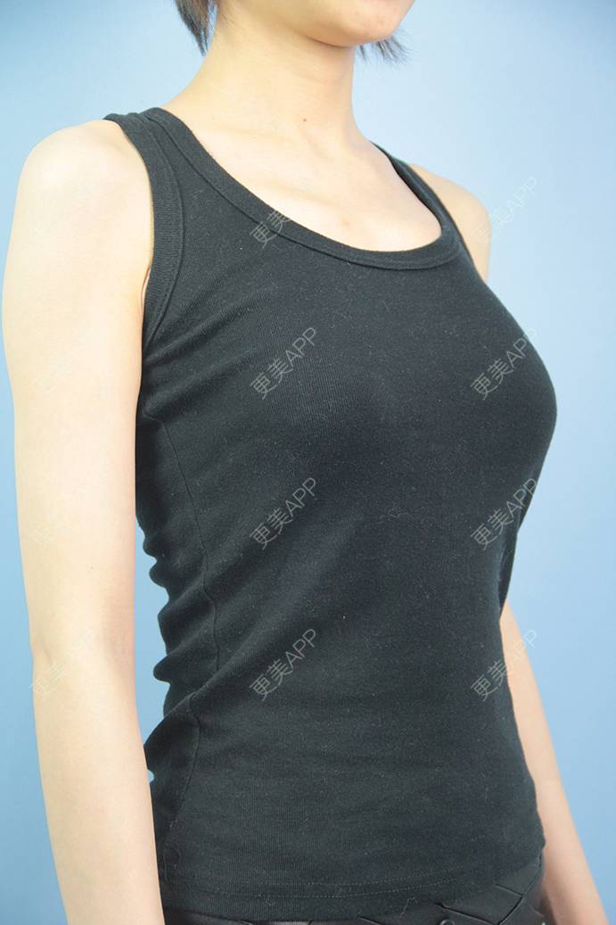 路过你的时光的丰胸隆胸日记