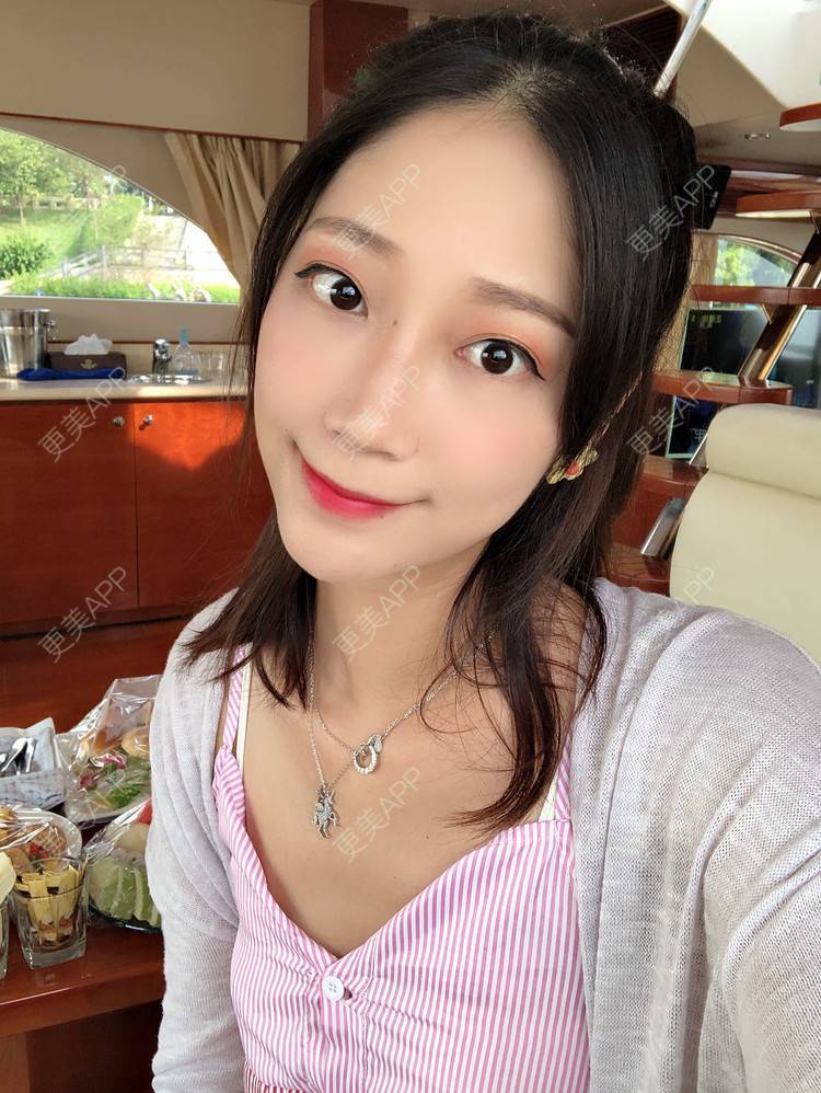 更美 - 眼神遇上对的人的埋线提升经验 | 视频日记 | 埋线提升 | 射频提升 | 广州