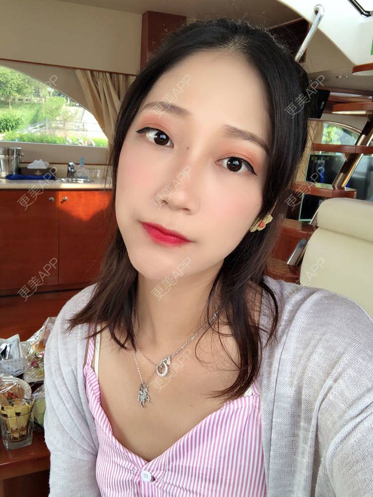 更美 - 眼神遇上对的人的埋线提升经验 | 视频日记 | 埋线提升 | 射频提升 | 广州