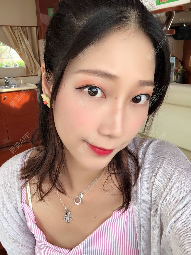 更美 - 眼神遇上对的人的埋线提升经验 | 视频日记 | 埋线提升 | 射频提升 | 广州