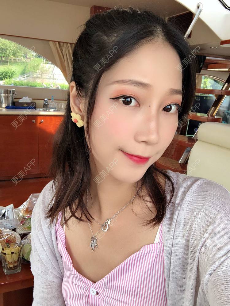 更美 - 眼神遇上对的人的埋线提升经验 | 视频日记 | 埋线提升 | 射频提升 | 广州