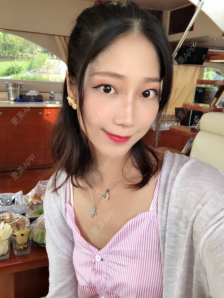 更美 - 眼神遇上对的人的埋线提升经验 | 视频日记 | 埋线提升 | 射频提升 | 广州