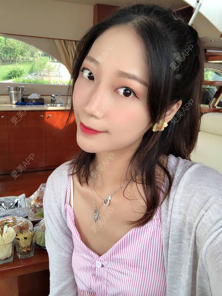 更美 - 眼神遇上对的人的埋线提升经验 | 视频日记 | 埋线提升 | 射频提升 | 广州