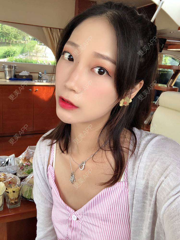 更美 - 眼神遇上对的人的埋线提升经验 | 视频日记 | 埋线提升 | 射频提升 | 广州