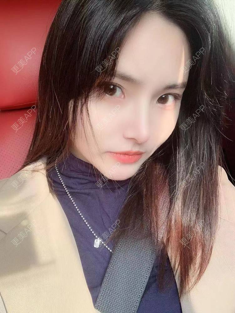更美 - 大美人图的自体脂肪丰额头经验 | 更美研究所 | 杭州 | 自体脂肪丰额头