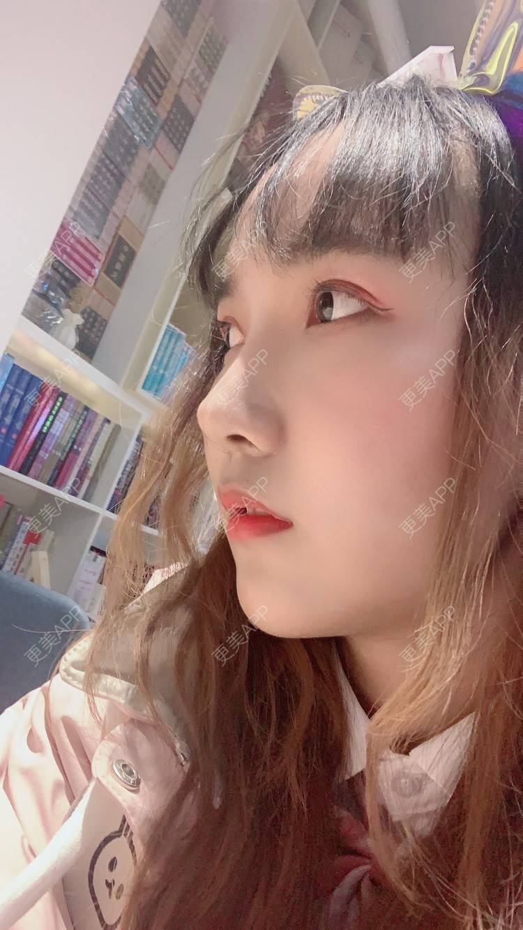 更美 - 林林兮兮的硅胶垫下巴经验 | 硅胶垫下巴 | 武汉