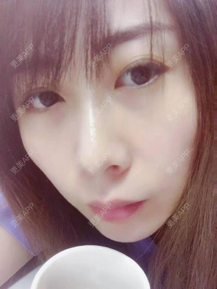 更美 - ジ深宫清妃づ先的清洁水光补水经验 | 清洁水光补水 | 深圳