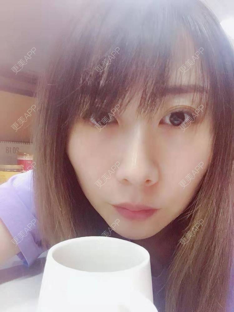 更美 - ジ深宫清妃づ先的清洁水光补水经验 | 清洁水光补水 | 深圳