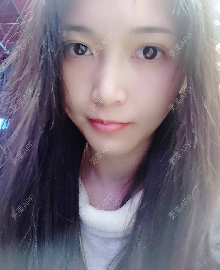 更美 - 温萝的清洁水光补水经验 | 广州 | 清洁水光补水