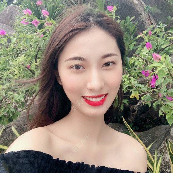 更美 - 木森曦夏荒凉年倬的双眼皮经验 | 双眼皮 | 曲靖