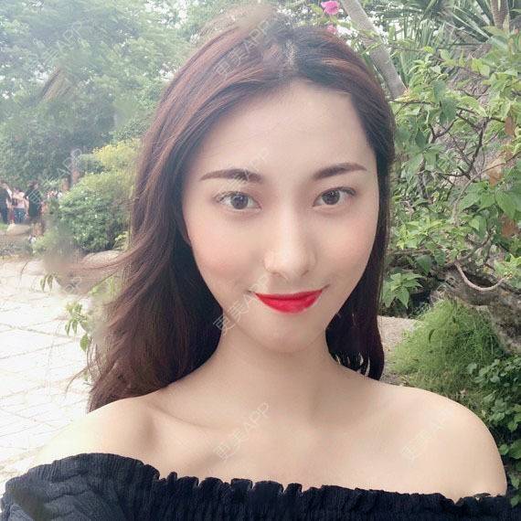 更美 - 木森曦夏荒凉年倬的双眼皮经验 | 双眼皮 | 曲靖