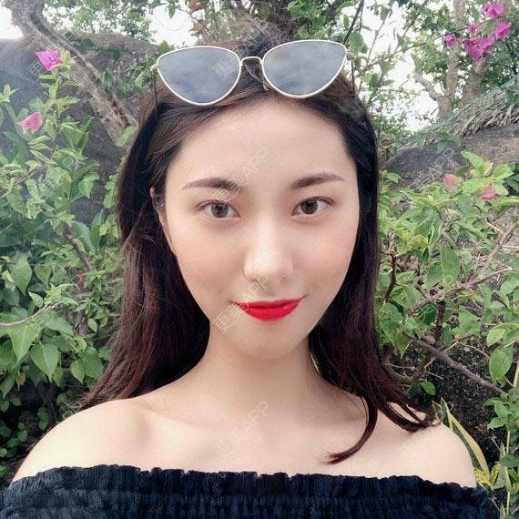 更美 - 木森曦夏荒凉年倬的双眼皮经验 | 双眼皮 | 曲靖