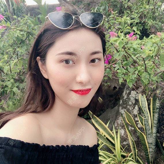 更美 - 木森曦夏荒凉年倬的双眼皮经验 | 双眼皮 | 曲靖