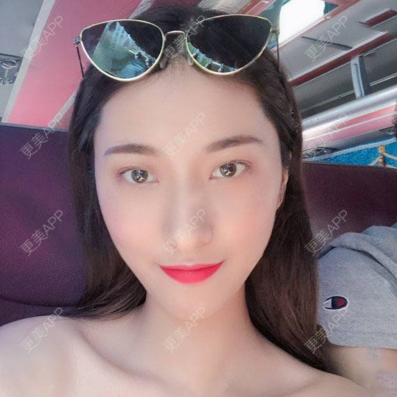更美 - 木森曦夏荒凉年倬的双眼皮经验 | 双眼皮 | 曲靖