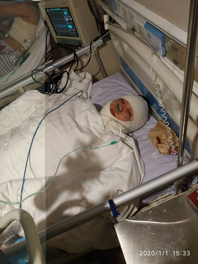 更美 - 更美用户WFzD4DOKgO的自体脂肪填充泪沟经验 | 自体脂肪填充泪沟 | 自体脂肪隆鼻 | 自体脂肪丰苹果肌 | 自体脂肪垫下巴 | 自体脂肪丰太阳穴 | 自体脂肪丰额头 | 吸脂 | 成都