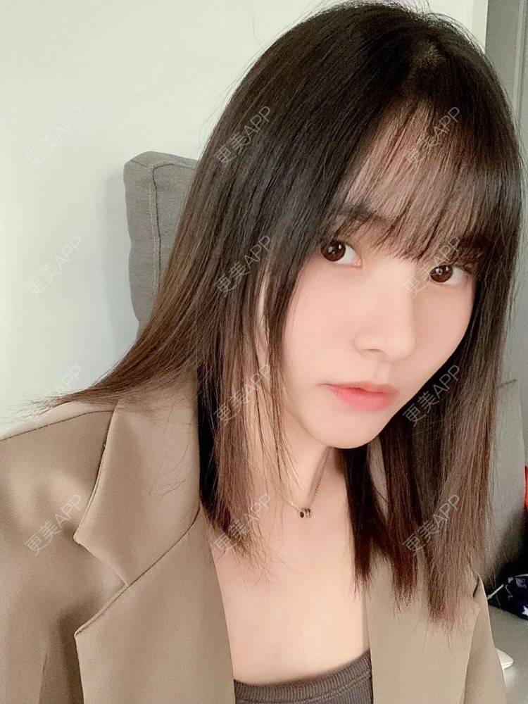 更美 - 大美人图的自体脂肪丰额头经验 | 更美研究所 | 杭州 | 自体脂肪丰额头