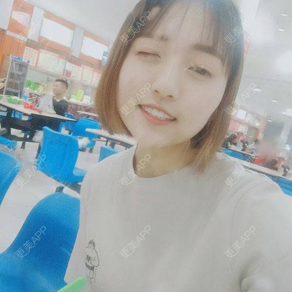 更美 - 天涯甜甜的果酸焕肤经验 | 果酸焕肤 | 六盘水