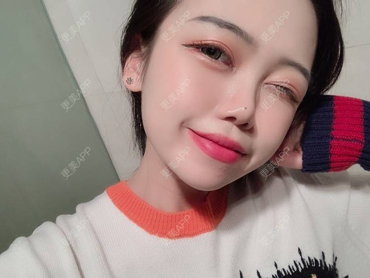 更美 - 更美用户DPh4BlmoOY的M唇成形经验 | M唇成形