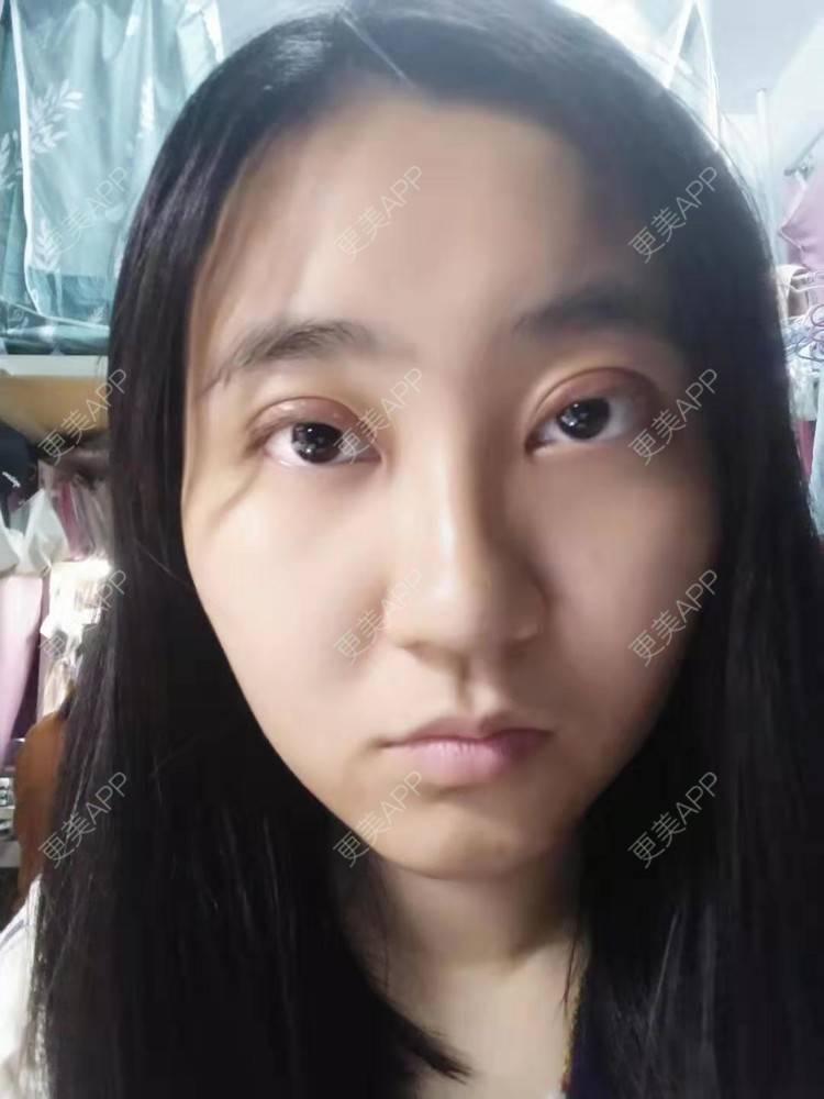 更美 - 你的女朋友的眼部多项经验 | 眼部多项 | 铜川