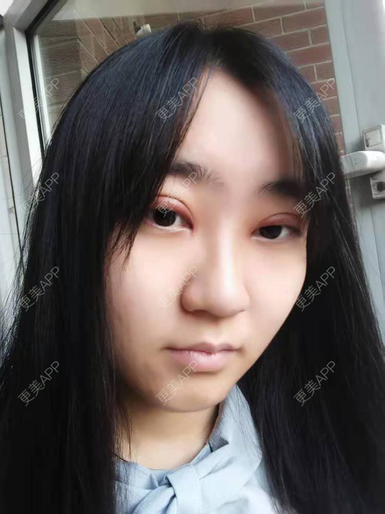 更美 - 你的女朋友的眼部多项经验 | 眼部多项 | 铜川