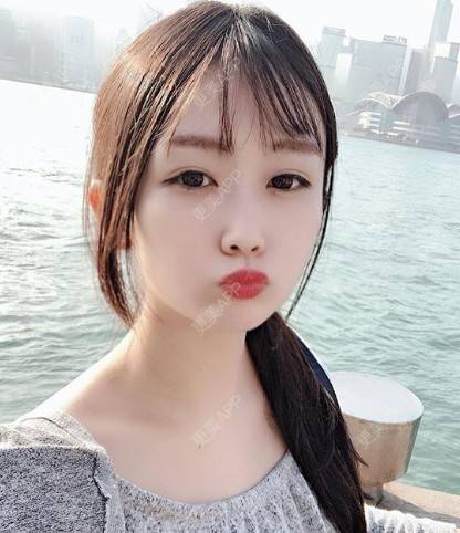 更美 - 更美用户G0TkvIPVpn的微针淡化妊娠纹经验 | 上海 | 微针淡化妊娠纹