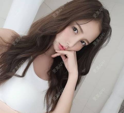 更美 - 更美用户rTjm6ltlIT的微针淡化妊娠纹经验 | 上海 | 微针淡化妊娠纹