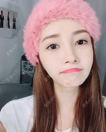 更美 - 更美用户rTjm6ltlIT的微针淡化妊娠纹经验 | 上海 | 微针淡化妊娠纹