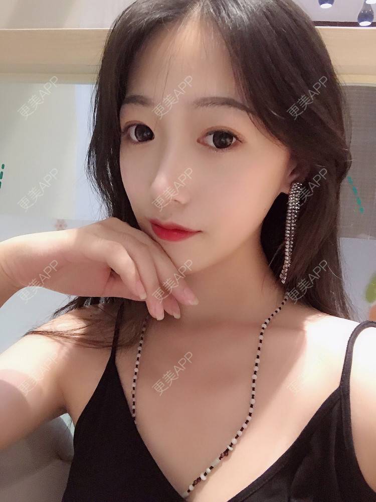 更美 - 更美用户RhEWOOeBRJ的玻尿酸下巴经验 | 玻尿酸下巴 | 重庆