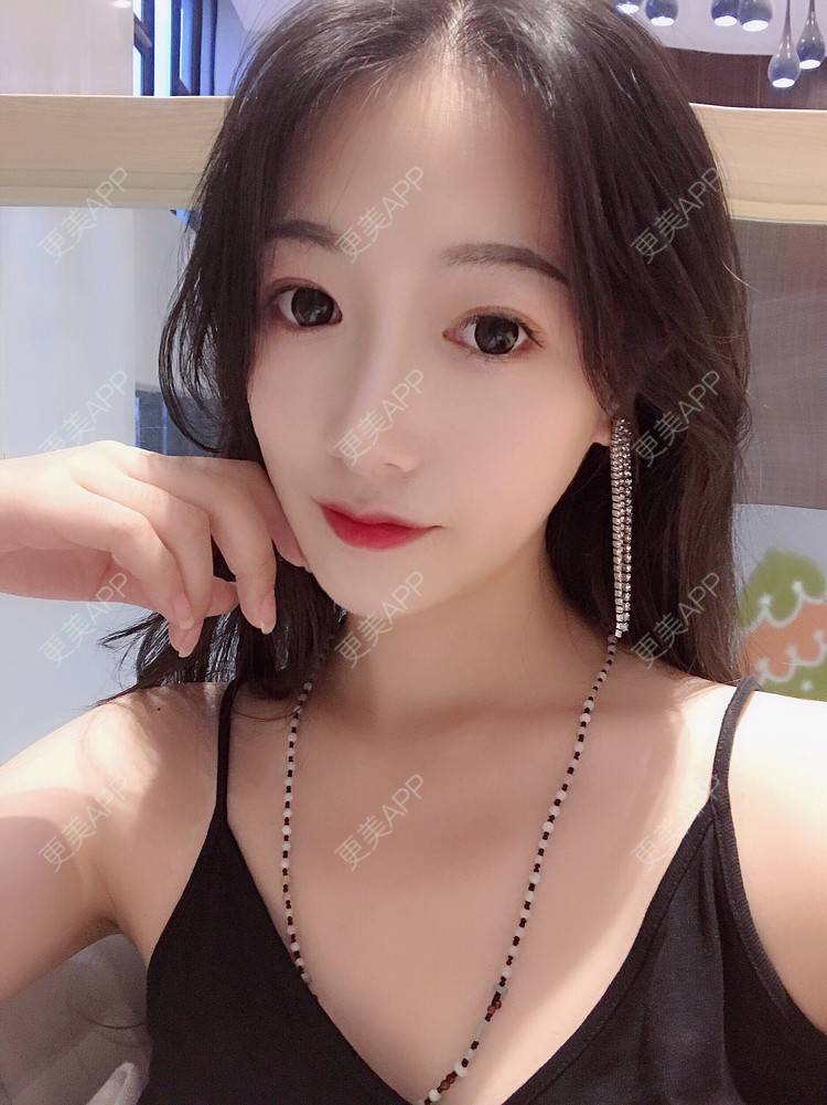 更美 - 更美用户RhEWOOeBRJ的玻尿酸下巴经验 | 玻尿酸下巴 | 重庆