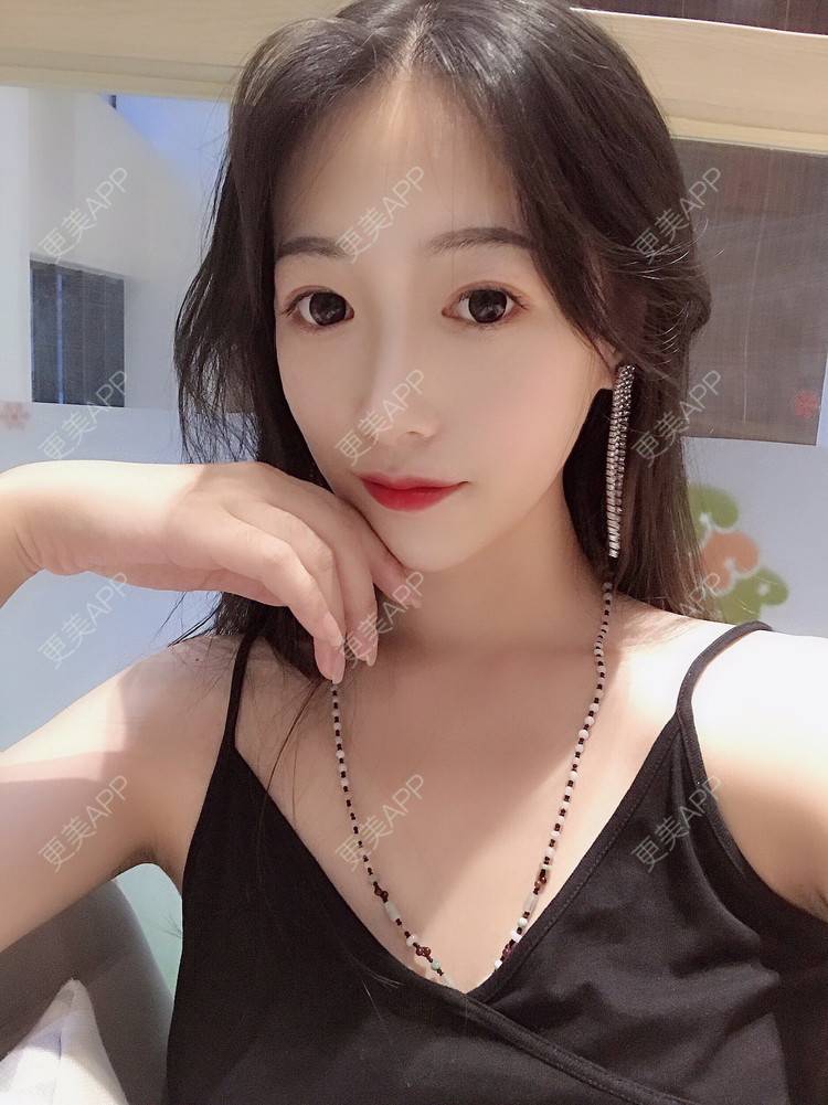 更美 - 更美用户RhEWOOeBRJ的玻尿酸下巴经验 | 玻尿酸下巴 | 重庆