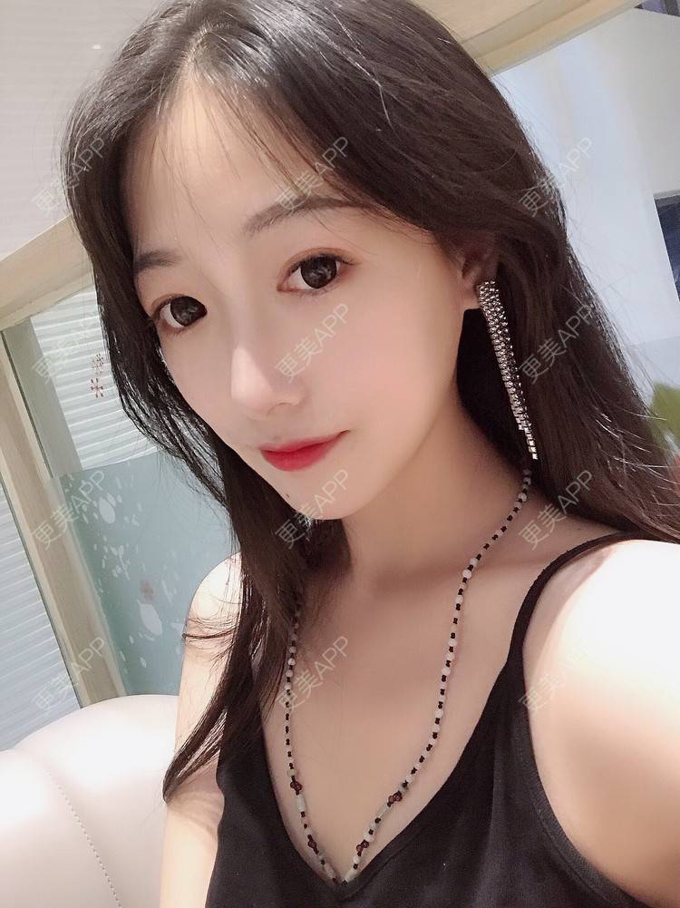 更美 - 更美用户RhEWOOeBRJ的玻尿酸下巴经验 | 玻尿酸下巴 | 重庆