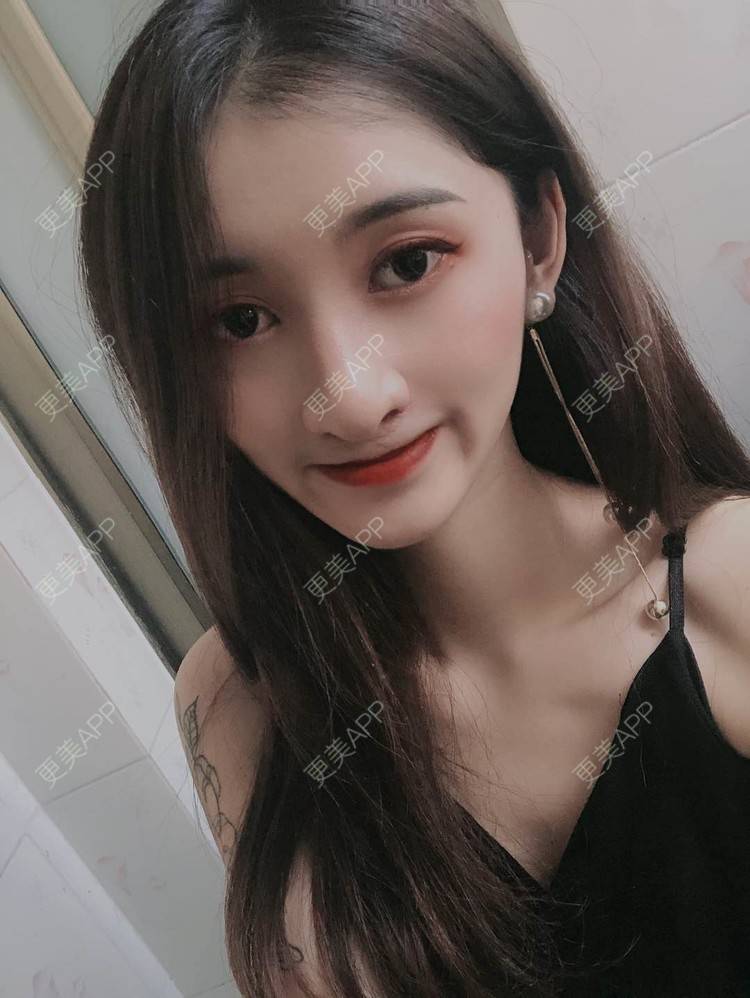 更美 - 最美的期待i的鼻形态修复经验 | 广州 | 鼻形态修复