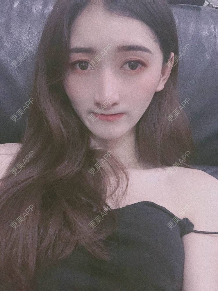 更美 - 最美的期待i的鼻形态修复经验 | 广州 | 鼻形态修复