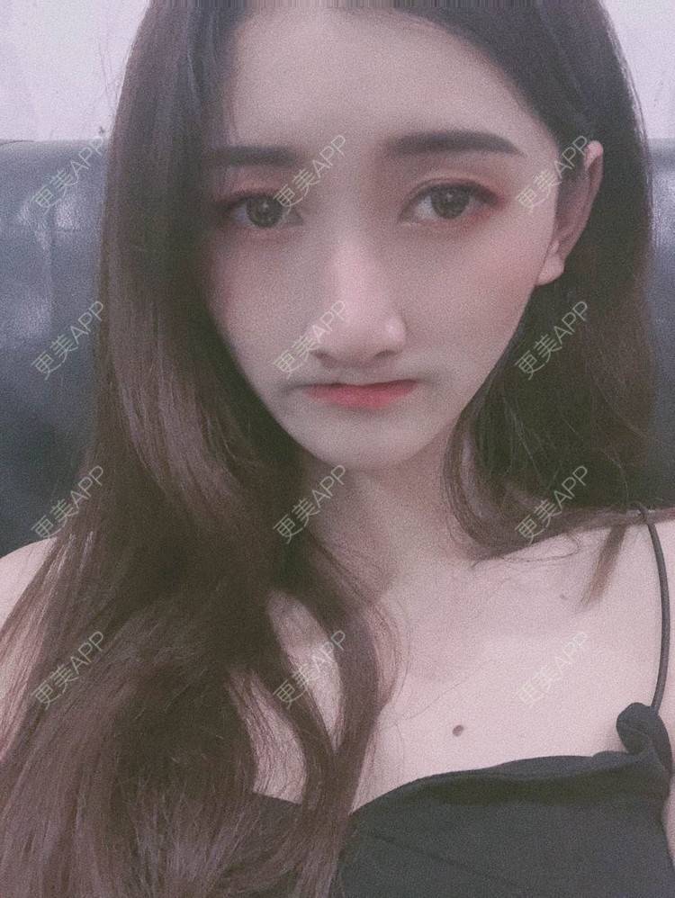 更美 - 最美的期待i的鼻形态修复经验 | 广州 | 鼻形态修复