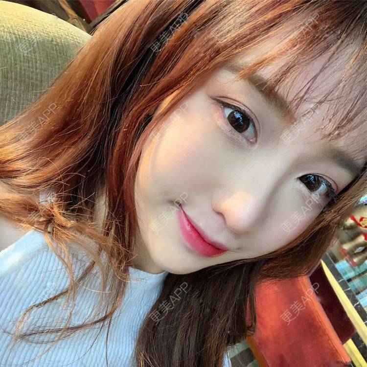 更美 - 更美用户SIiWdJ0xDj的眼部多项经验 | 眼部多项 | 视频日记 | 佛山