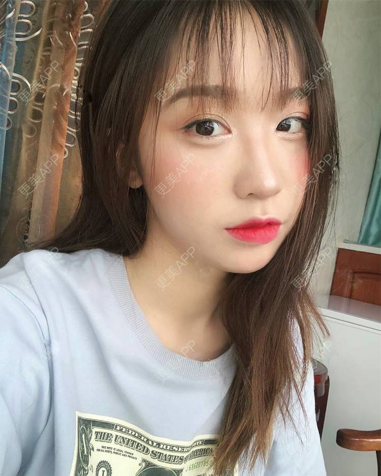 更美 - 更美用户SIiWdJ0xDj的眼部多项经验 | 眼部多项 | 视频日记 | 佛山