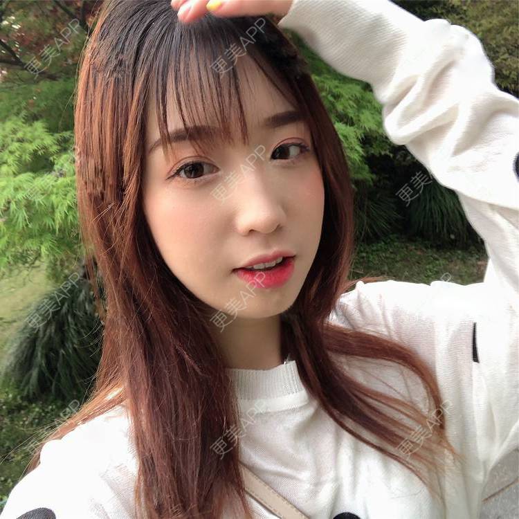 更美 - 更美用户SIiWdJ0xDj的眼部多项经验 | 眼部多项 | 视频日记 | 佛山