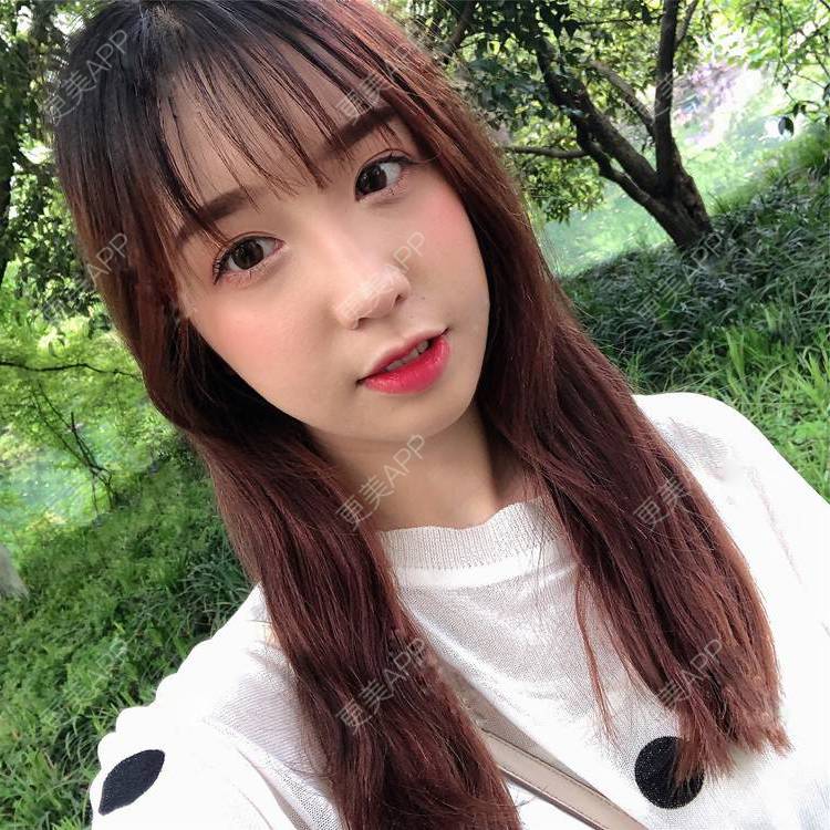 更美 - 更美用户SIiWdJ0xDj的眼部多项经验 | 眼部多项 | 视频日记 | 佛山