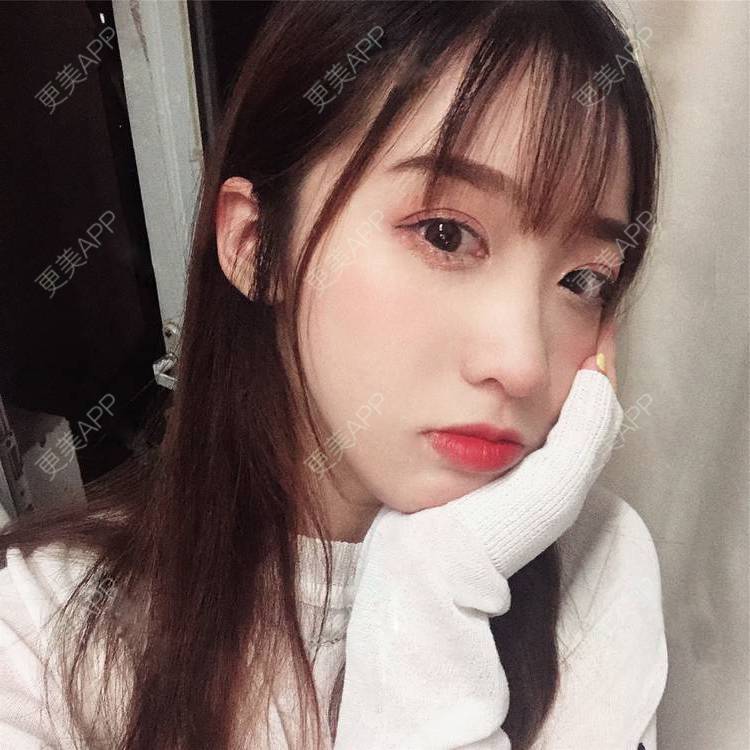 更美 - 更美用户SIiWdJ0xDj的眼部多项经验 | 眼部多项 | 视频日记 | 佛山