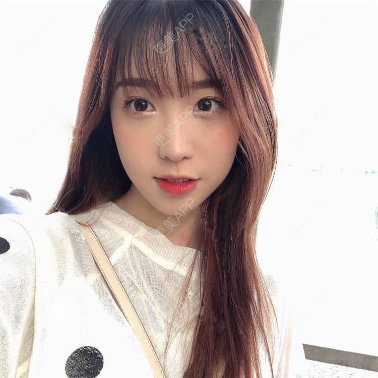 更美 - 更美用户SIiWdJ0xDj的眼部多项经验 | 眼部多项 | 视频日记 | 佛山