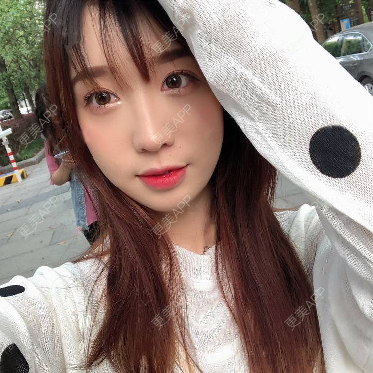 更美 - 更美用户SIiWdJ0xDj的眼部多项经验 | 眼部多项 | 视频日记 | 佛山