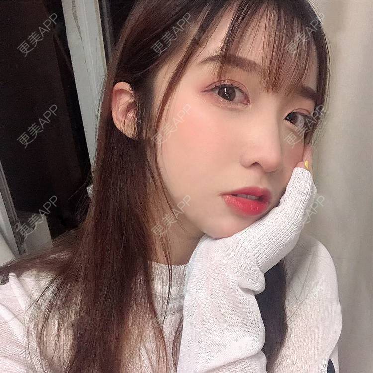 更美 - 更美用户SIiWdJ0xDj的眼部多项经验 | 眼部多项 | 视频日记 | 佛山