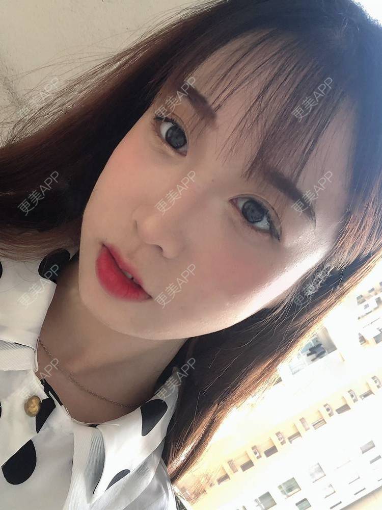 更美 - 更美用户SIiWdJ0xDj的眼部多项经验 | 眼部多项 | 视频日记 | 佛山