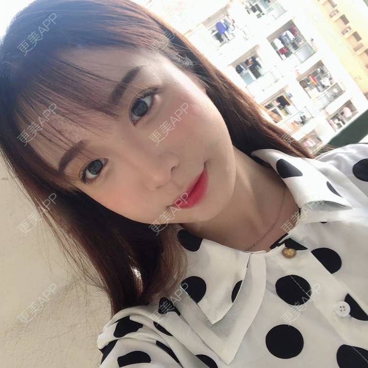 更美 - 更美用户SIiWdJ0xDj的眼部多项经验 | 眼部多项 | 视频日记 | 佛山