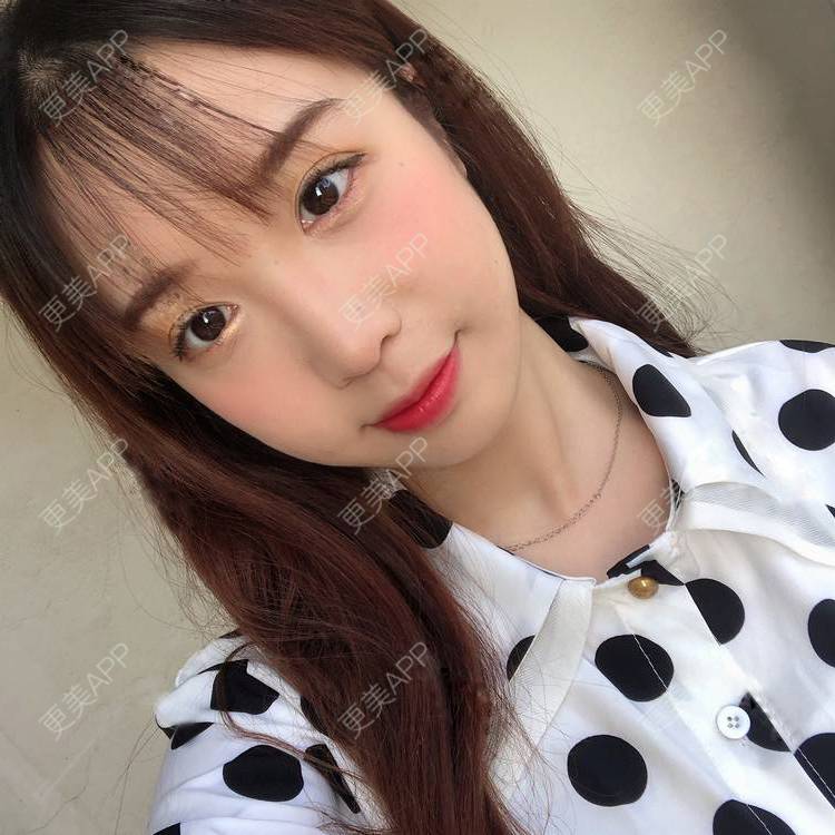 更美 - 更美用户SIiWdJ0xDj的眼部多项经验 | 眼部多项 | 视频日记 | 佛山