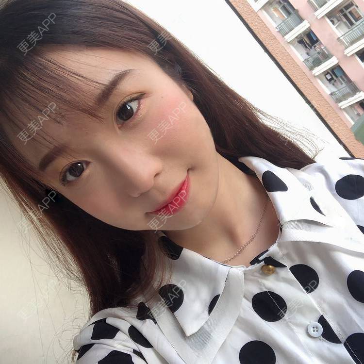 更美 - 更美用户SIiWdJ0xDj的眼部多项经验 | 眼部多项 | 视频日记 | 佛山