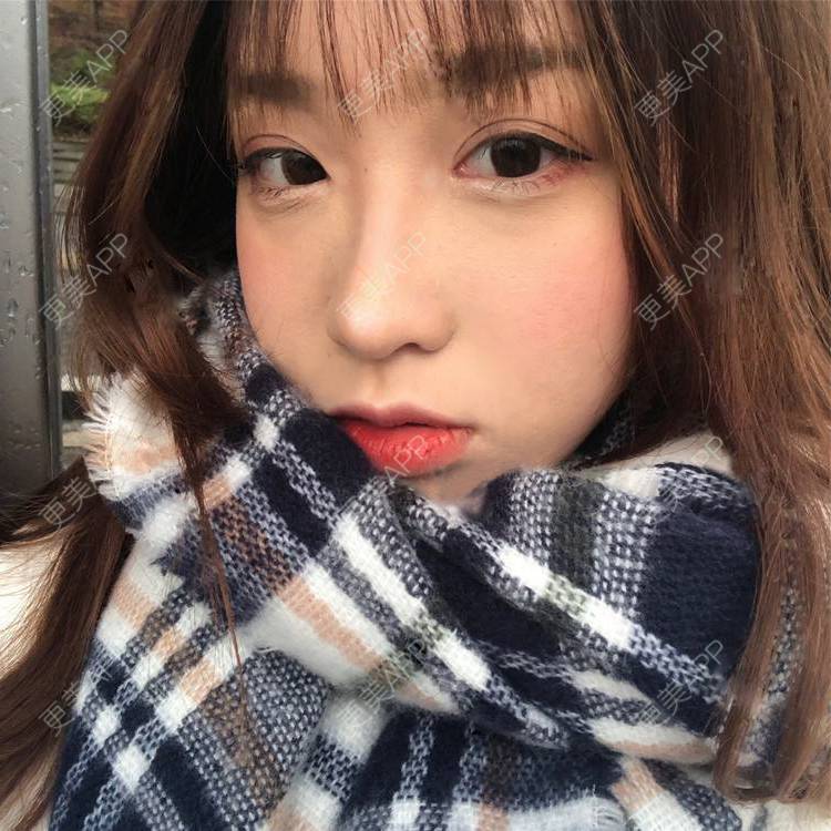 更美 - 更美用户SIiWdJ0xDj的眼部多项经验 | 眼部多项 | 视频日记 | 佛山