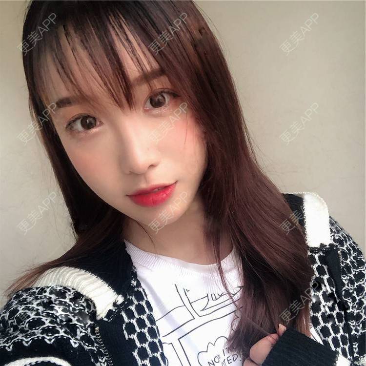 更美 - 更美用户SIiWdJ0xDj的眼部多项经验 | 眼部多项 | 视频日记 | 佛山