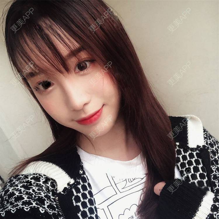 更美 - 更美用户SIiWdJ0xDj的眼部多项经验 | 眼部多项 | 视频日记 | 佛山