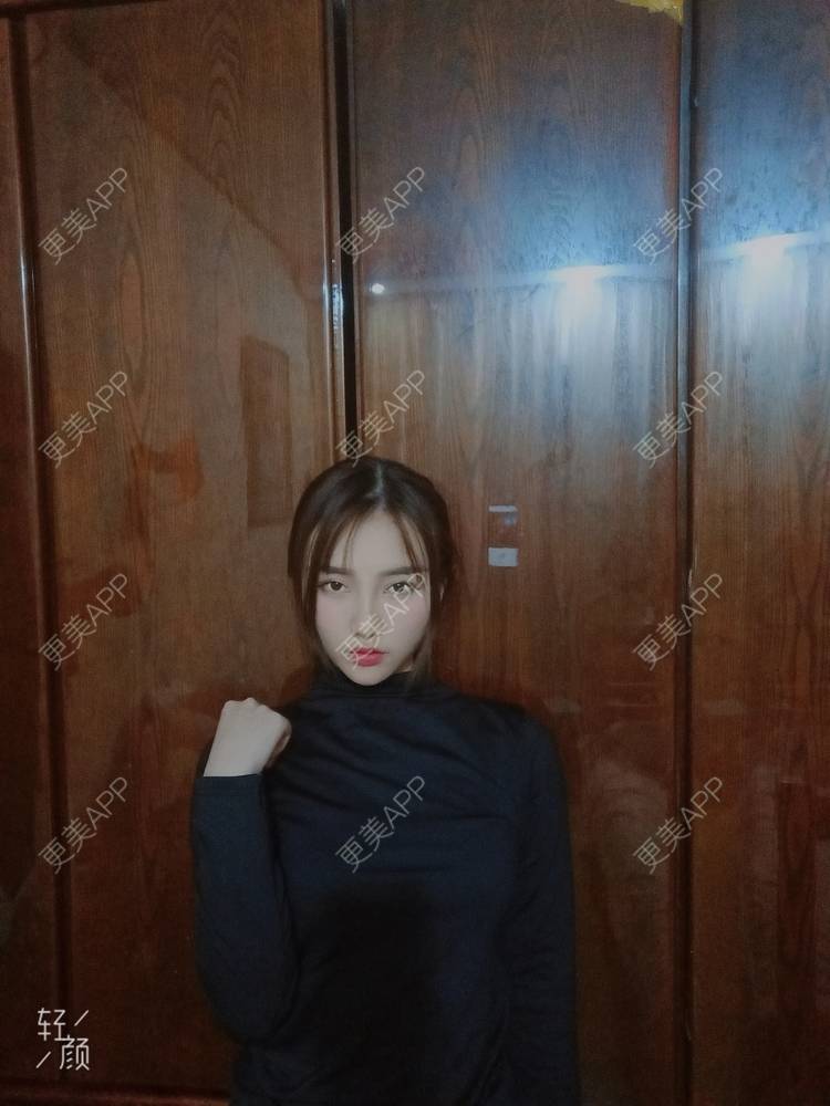 更美 - 青苔上的蜗牛的吸脂瘦脸经验 | 吸脂瘦脸 | 重庆